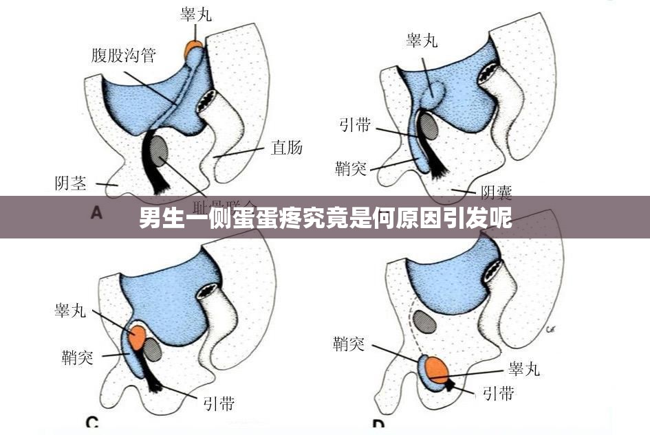 男生一側(cè)蛋蛋疼究竟是何原因引發(fā)呢